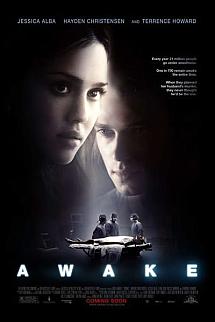 Anestezi izle